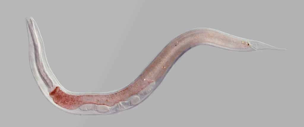 Roundworm under miicroscope.