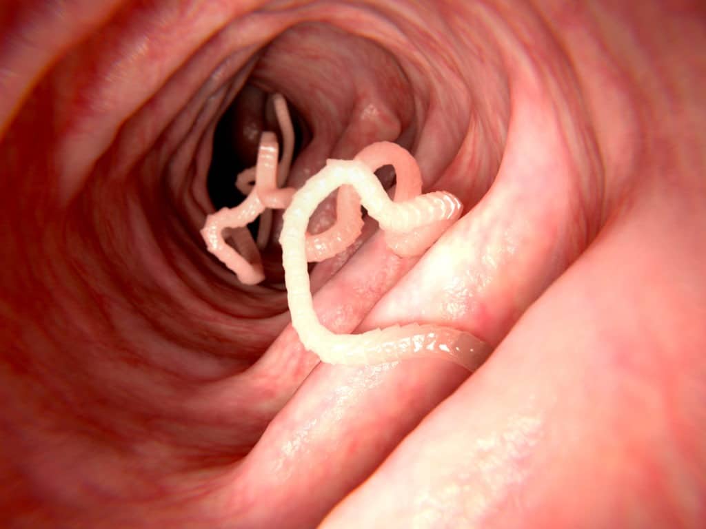 Tapeworms.